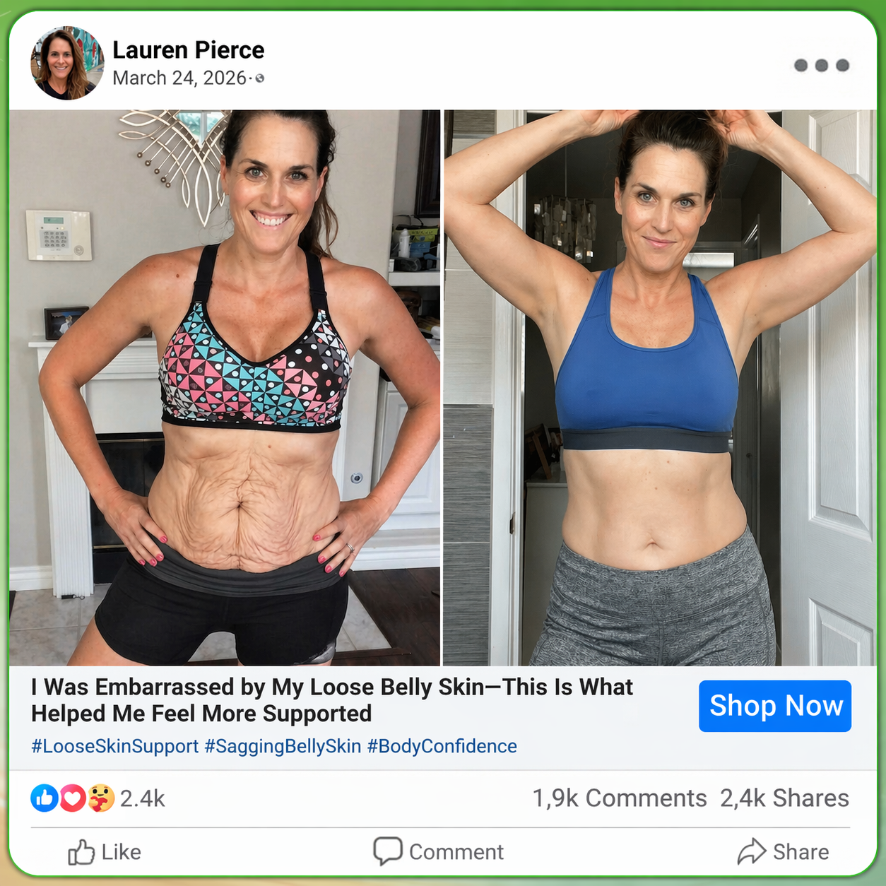 𝑶𝒇𝒇𝒊𝒄𝒊𝒂𝒍 𝑺𝒕𝒐𝒓𝒆  | 🇨🇦🇨🇦𝐂𝐚𝐫𝐞𝐔𝐩𝐥𝐢𝐟𝐭® 𝙈𝒐𝒓𝒊𝒏𝒈𝗮 · 𝗕𝗲𝗿𝗯𝐞𝐫𝐢𝐧𝙚 × 𝙉𝑨𝑫+ 𝟏𝟎-𝙞𝙣-𝟏 𝘼𝒅𝒗𝒂𝒏𝒄𝒆𝐝 𝐍𝐚𝐧𝙤 𝙈𝙞𝙘𝙧𝙤𝙣𝒆𝒆𝒅𝒍𝐞 𝐏𝐚𝐭𝙘𝙝(𝐉𝐮𝐬𝐭 𝐨𝐧𝐜𝐞 𝐚 𝐝𝐚𝐲, 𝐯𝐢𝐬𝐢𝐛𝐥𝐞 𝐜𝐡𝐚𝐧𝐠𝐞𝐬 𝐢𝐧 𝟕 𝐝𝐚𝐲𝐬） ✅ 𝐅𝐨𝐫 𝐨𝐛𝐞𝐬𝐢𝐭𝐲, 🅛🅞🅞🅢🅔 🅢🅚🅘🅝,𝐝𝐢𝐚𝐛𝐞𝐭𝐞𝐬, 𝐬𝐥𝐞𝐞𝐩 𝐚𝐩𝐧𝐞𝐚, 𝐣𝐨𝐢𝐧𝐭 𝐢𝐬𝐬𝐮𝐞𝐬, 𝐚𝐧𝐝 𝐦𝐨𝐫𝐞