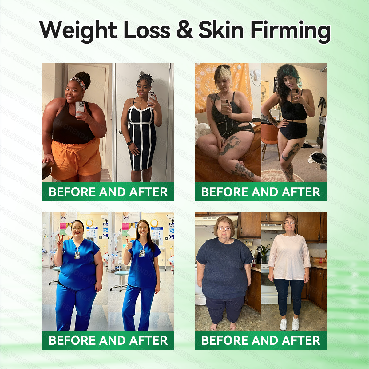 🇨🇦𝑶𝒇𝒇𝒊𝒄𝒊𝒂𝒍 𝑺𝒕𝒐𝒓𝒆  | 💖💖 𝐂𝐚𝐫𝐞𝐔𝐩𝐥𝐢𝐟𝐭® 𝙈𝒐𝒓𝒊𝒏𝒈𝗮 · 𝗕𝗲𝗿𝗯𝐞𝐫𝐢𝐧𝙚 × 𝙉𝑨𝑫+ 𝟏𝟎-𝙞𝙣-𝟏 𝘼𝒅𝒗𝒂𝒏𝒄𝒆𝐝 𝐍𝐚𝐧𝙤 𝙈𝙞𝙘𝙧𝙤𝙣𝒆𝒆𝒅𝒍𝐞 𝐏𝐚𝐭𝙘𝙝(𝐉𝐮𝐬𝐭 𝐨𝐧𝐜𝐞 𝐚 𝐝𝐚𝐲, 𝐯𝐢𝐬𝐢𝐛𝐥𝐞 𝐜𝐡𝐚𝐧𝐠𝐞𝐬 𝐢𝐧 𝟕 𝐝𝐚𝐲𝐬） ✅ 𝐅𝐨𝐫 𝐨𝐛𝐞𝐬𝐢𝐭𝐲, 🅛🅞🅞🅢🅔 🅢🅚🅘🅝,𝐝𝐢𝐚𝐛𝐞𝐭𝐞𝐬, 𝐬𝐥𝐞𝐞𝐩 𝐚𝐩𝐧𝐞𝐚, 𝐣𝐨𝐢𝐧𝐭 𝐢𝐬𝐬𝐮𝐞𝐬, 𝐚𝐧𝐝 𝐦𝐨𝐫𝐞